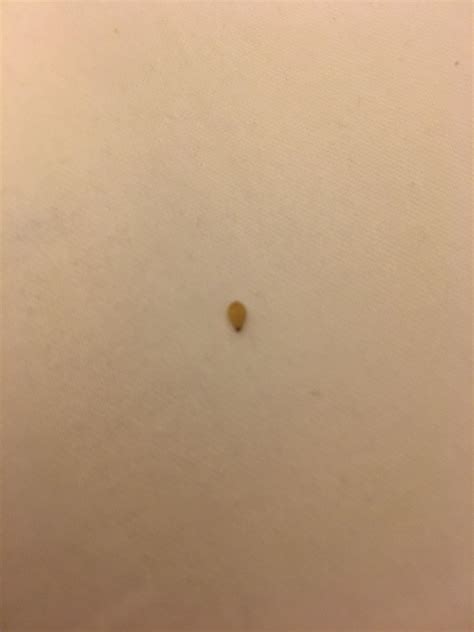 Is this a bed bug egg? : r/Bedbugs