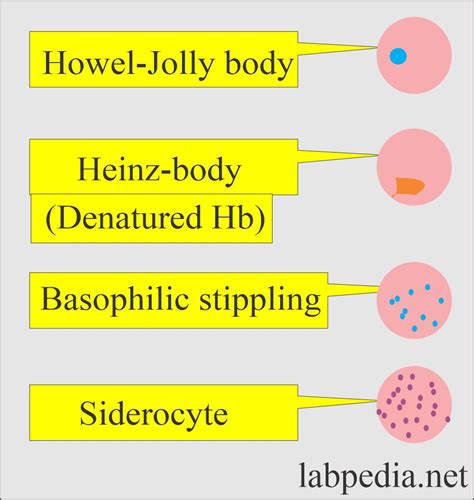 Reticulocyte Vs Heinz Body