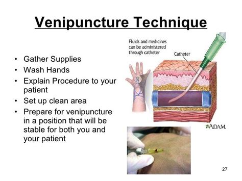 Venipuncture Technique Gather Supplies Wash Hands Explain Procedure t… | Medical knowledge ...