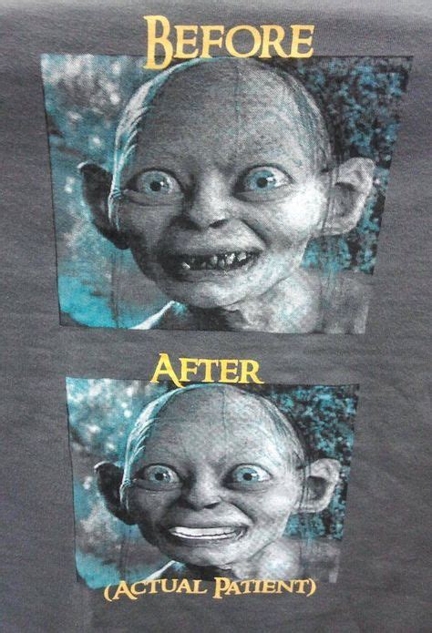 Gollum, before and after | Because it makes me Smile | Dental jokes ...