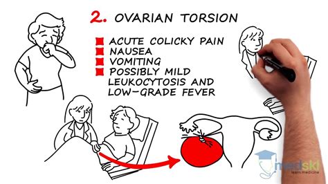 Obstetrics and Gynecology – Pelvic Pain: By Leslie Po M.D. - YouTube