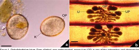 [PDF] Diphyllobothrium latum and Diphyllobothrium sp. as the agents of ...