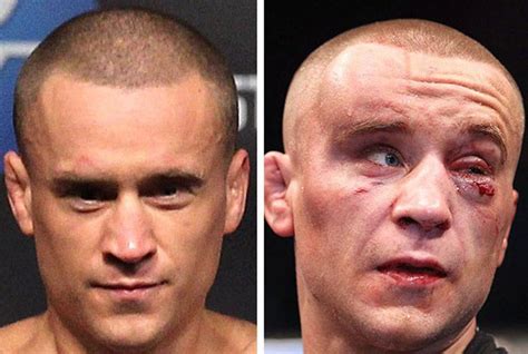 UFC Fighters Before And After A Fight (15 pics)