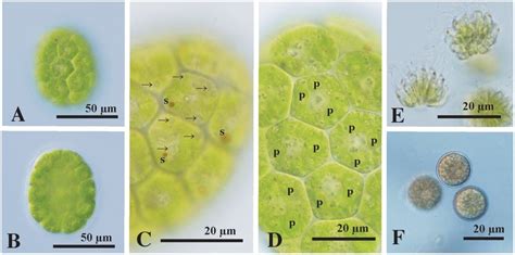 Light microscopy of Eudorina compacta Nozaki sp. nov. originating from ...