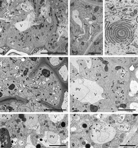 Development of vacuoles in nematode-induced syncytia. Transmission... | Download Scientific Diagram