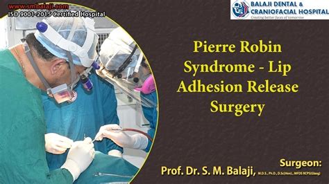 Amazing Facts about Pierre Robin Syndrome and Treatment