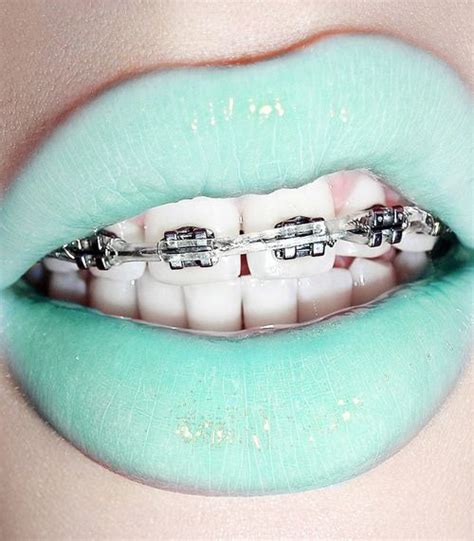 Green Braces Lips #makeup, #lips, https://facebook.com/apps/application.php?id=106186096099420 ...