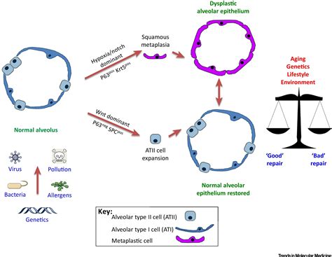 Lung Alveolar Repair: Not All Cells Are Equal: Trends in Molecular Medicine