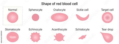 Schistocyte