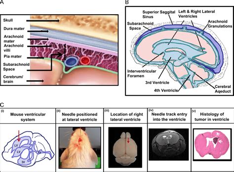 Meninges, ventricular system and meningeal metastases model. Meninges ...