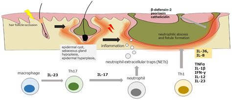 Diagnostics | Free Full-Text | The Development of Systemic Inflammatory ...