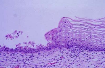 Uterus Histology - Cervix - histology slide