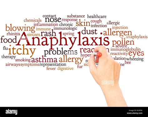 Anaphylaxis rash Cut Out Stock Images & Pictures - Alamy