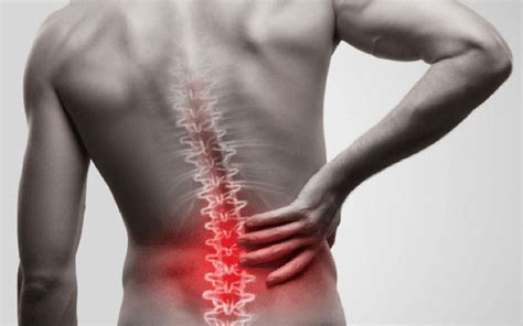 Lower Back Pain Due To Spinal Arthritis Non-Surgical Pain Management Options