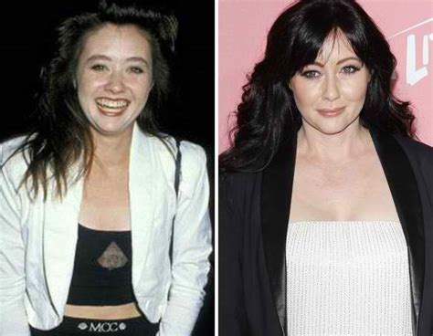 Chatter Busy: Shannen Doherty Plastic Surgery