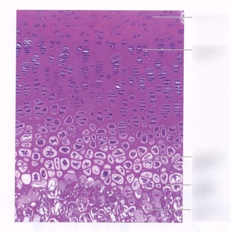 Bone & Cartilage Histology Diagram | Quizlet