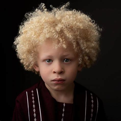 5-year-old аlbino boy has become a model after his mother posted a photo of him on Facebook