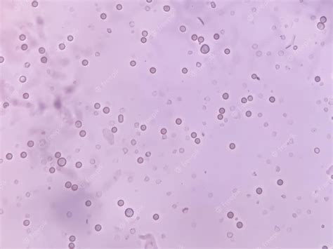 Premium Photo | Rbc wbc and bacteria in urine specimen analysed by microscope