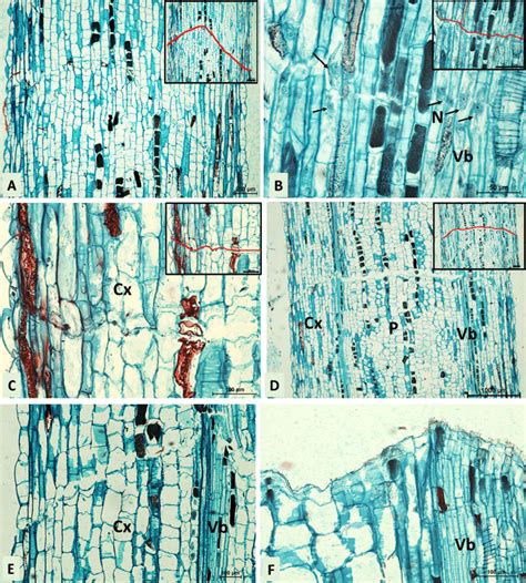 Microscopy investigation of the secondary abscission zone in the middle... | Download Scientific ...