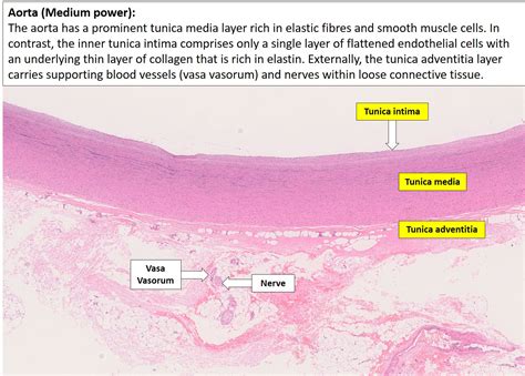 Blood vessels – Normal Histology – NUS Pathweb :: NUS Pathweb