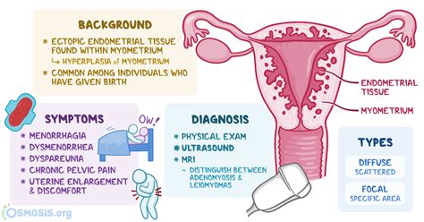 Adenomyosis Causes Signs Symptoms Treatment Risk Factors Diagnosis | Hot Sex Picture