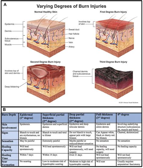 Image result for burn depth 1-4 | Subcutaneous tissue, Burns treatment ...