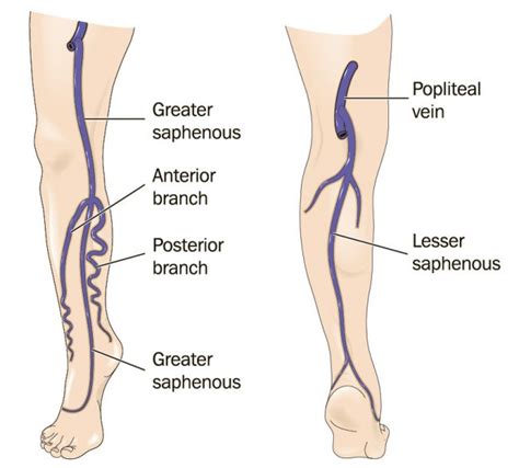 What are the symptoms of venous reflux? - Dekalb Vein Center