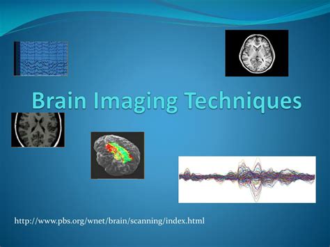 PPT - Brain Imaging Techniques PowerPoint Presentation, free download ...