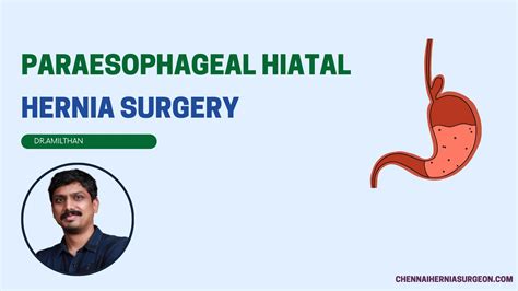 Paraesophageal hiatal hernia surgery