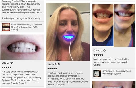 Best At-Home Teeth Whitening System- Snow Teeth Whitening