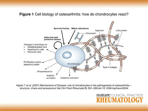 PPT - Figure 1 Cell biology of osteoarthritis: how do chondrocytes ...