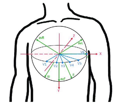 Reciprocal Changes and Occlusion MI | ECG Cases | Emergency Medicine Cases