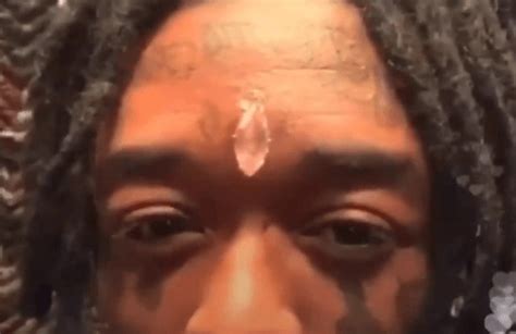 Lil Uzi Vert Explains Why He Got a Diamond Implanted on His Forehead ...