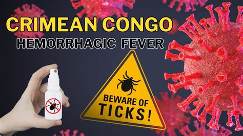 CCHF: Crimean Congo Hemorrhagic Fever Symptoms and Treatment for CCHF ...