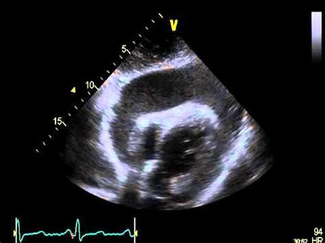 How Long Do Dogs Live With Pericardial Effusion - BikeHike