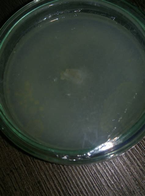 Yellow spots in agar. Bacteria? - Mushroom Cultivation - Shroomery ...