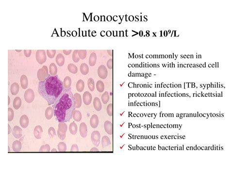 PPT - Morphologic and Distributive Leukocyte Disorders PowerPoint Presentation - ID:73418