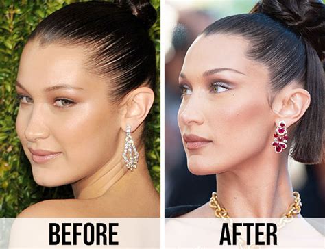 Bella Hadid Then & Now: See How Much Her Face Has Changed Over The Years - SHEfinds