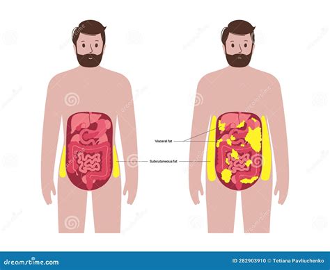 Visceral Fat Diagram Vector Illustration | CartoonDealer.com #281348440