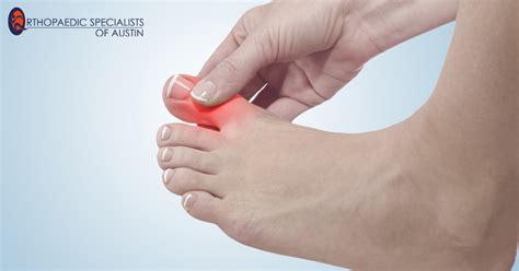 Toe Surgery | Orthopaedic Specialists of Austin