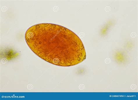 Egg of Intestinal Fluke in Human Stool Stock Photo - Image of analyzing ...