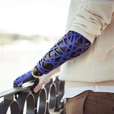 UNYQ launches collection of 3D printed prosthetic upper limb covers | 3d printing, Prosthetics ...