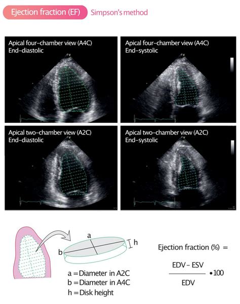 Ejection fraction (EF): Physiology, Measurement & Clinical Evaluation – Cardiovascular Education