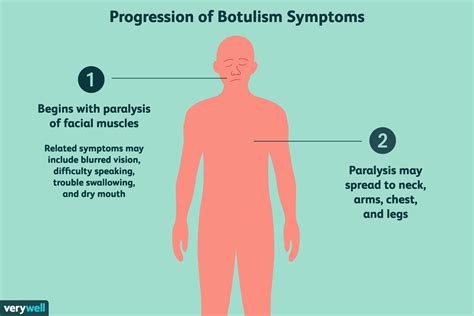 Botulism: Overview and More