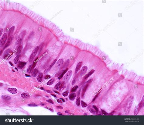 Ciliated Pseudostratified Columnar Epithelium Trachea Respiratory Stock Photo 159810464 ...