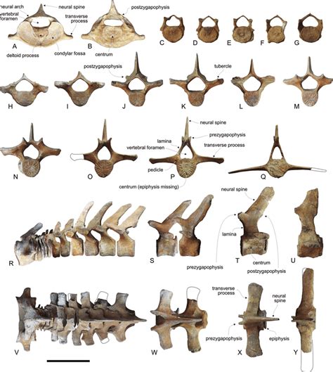 Cervical Thoracic And Lumbar Vertebrae