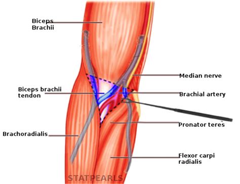 Antecubital fossa - Definition and Examples - Biology Online Dictionary