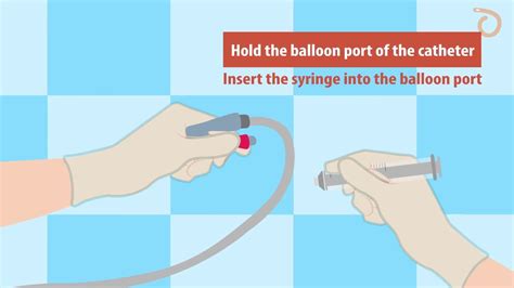 To remove the Foley Catheter on a Female patient, you must use the syringe to extract the water ...