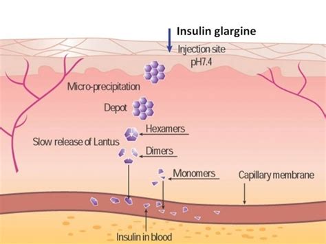 Global Insulin Glargine Market Manufactures and Key Statistics Analysis Report 2017