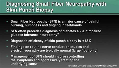 Small Fiber Neuropathy | Neuropathy Journal